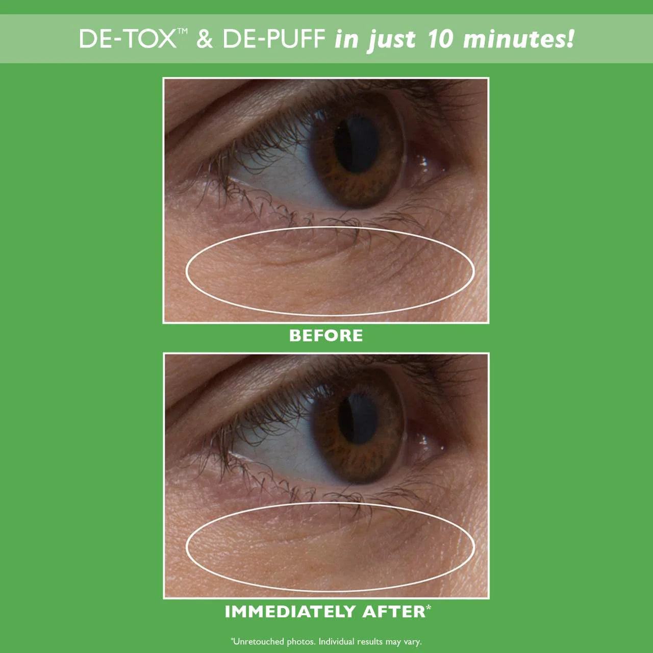 Clinically Stronger Hydra-Gel Eye Patches