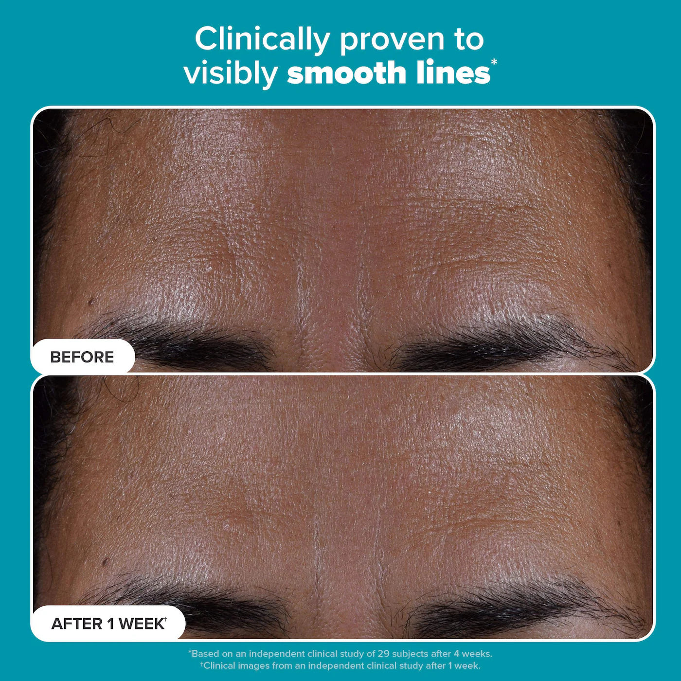 Skin Perfecting 2% BHA Exfoliating Toner Pads for Clear Skin