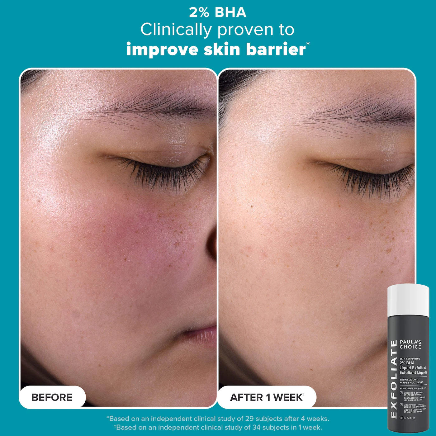 Smooth & Glow Gift Set for clearer, brighter skin