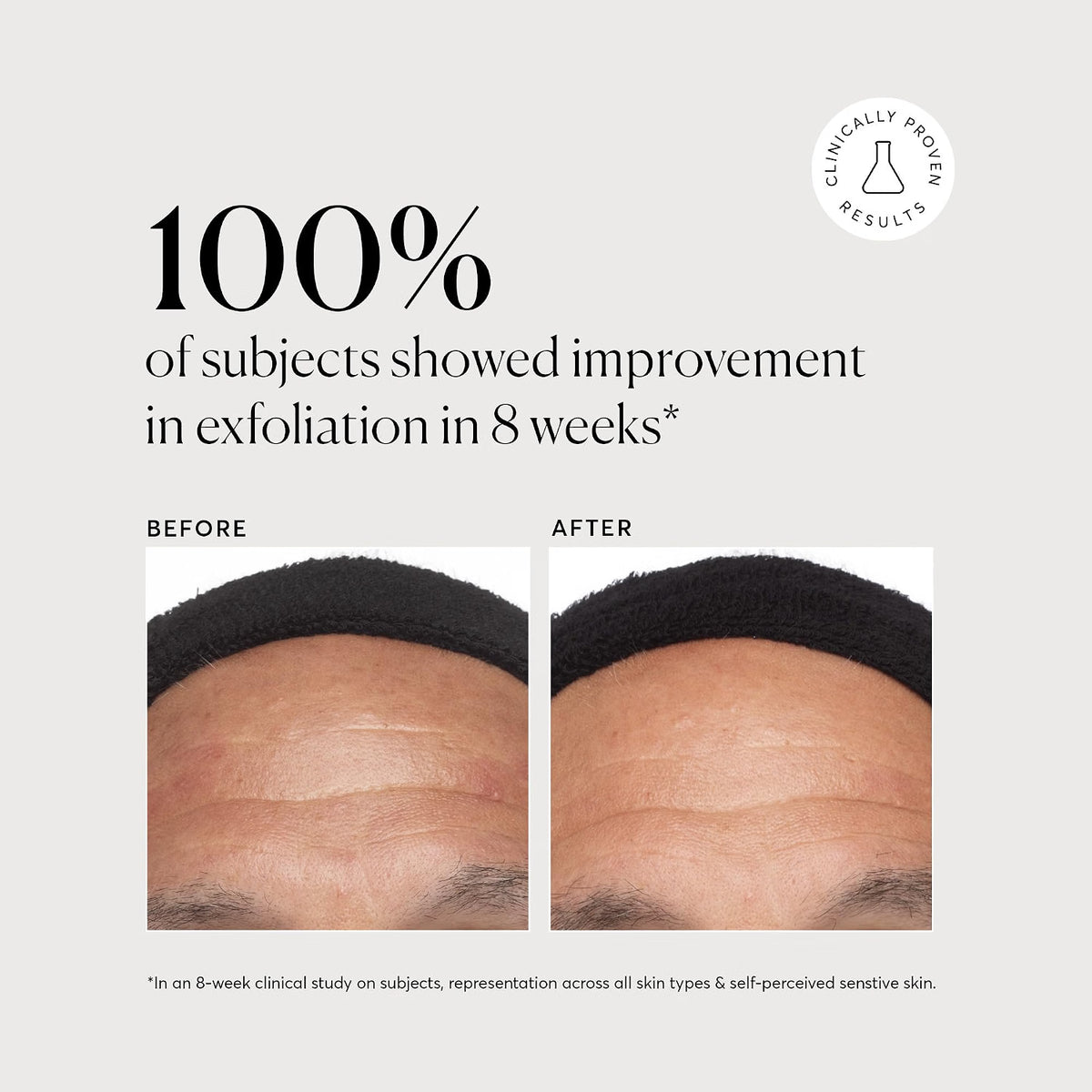 Naturium Azelaic Acid Derivative Complex 10% Serum