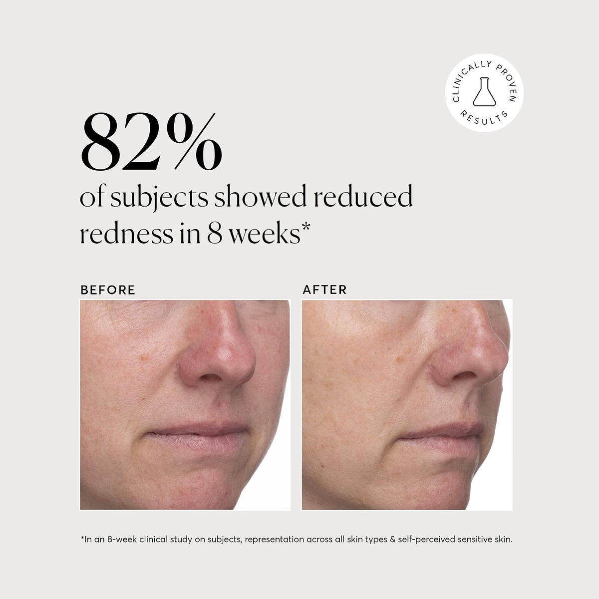 Naturium Azelaic Acid Derivative Complex 10% Serum