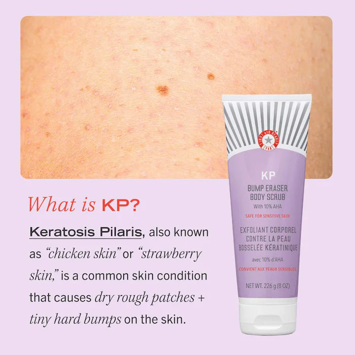 KP Bump Eraser Body Scrub with 10% AHA – Body Exfoliant for Keratosis Pilaris