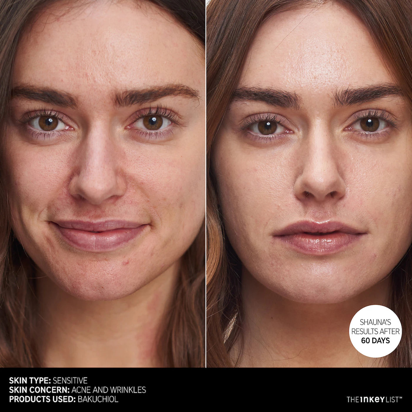 Bakuchiol Retinol Alternative Moisturizer