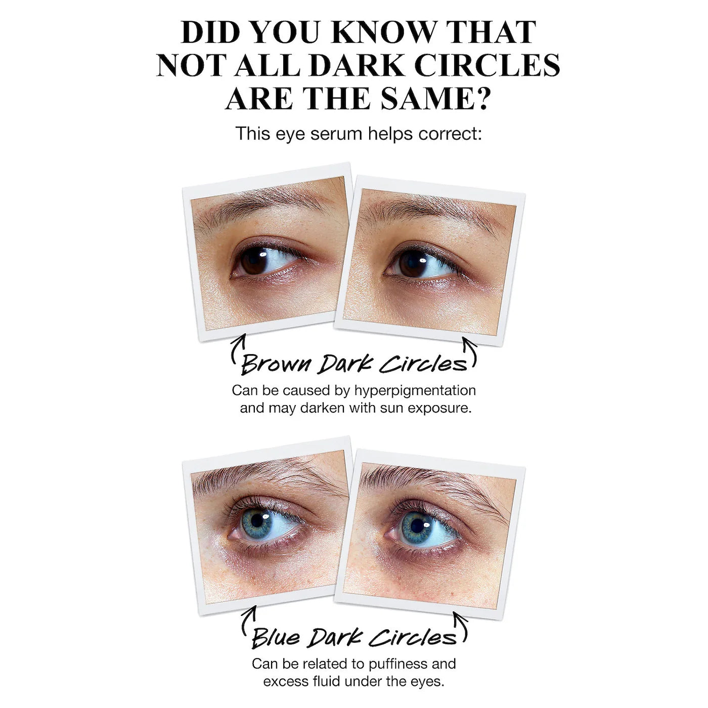 Powerful-Strength Dark Circle Reducing Vitamin C Eye Serum