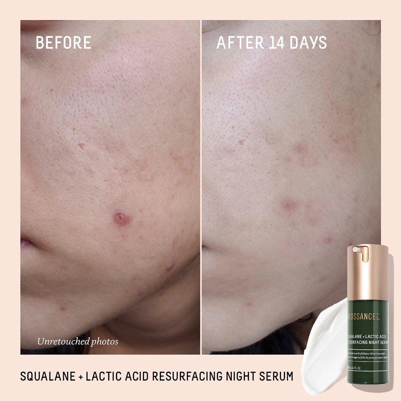 Squalane + 10% Lactic Acid Resurfacing Night Serum