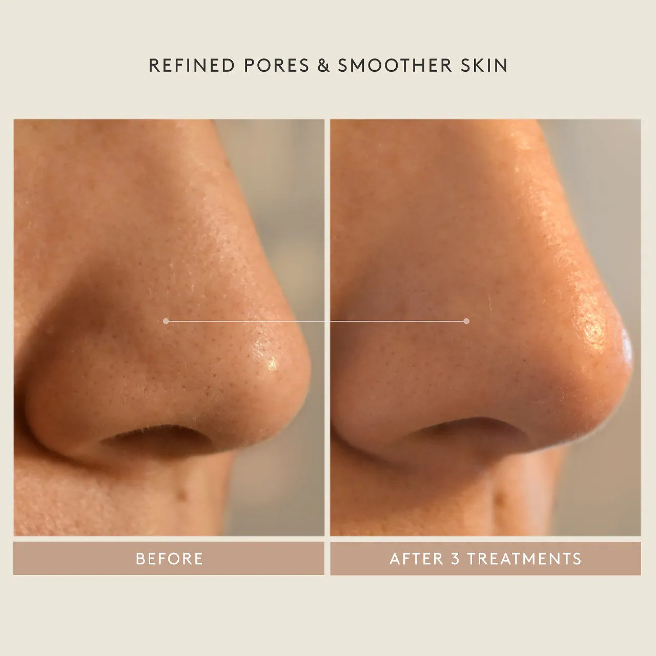 Triple Acid Signature Peel