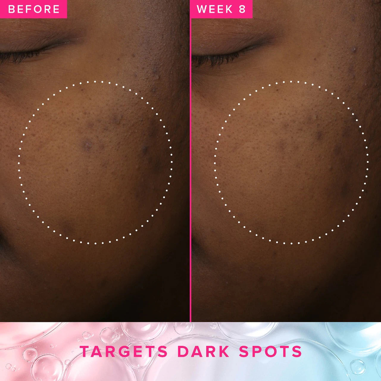 Brighten Up 3% TXA Dark Spot Toner with Azelaic Acid