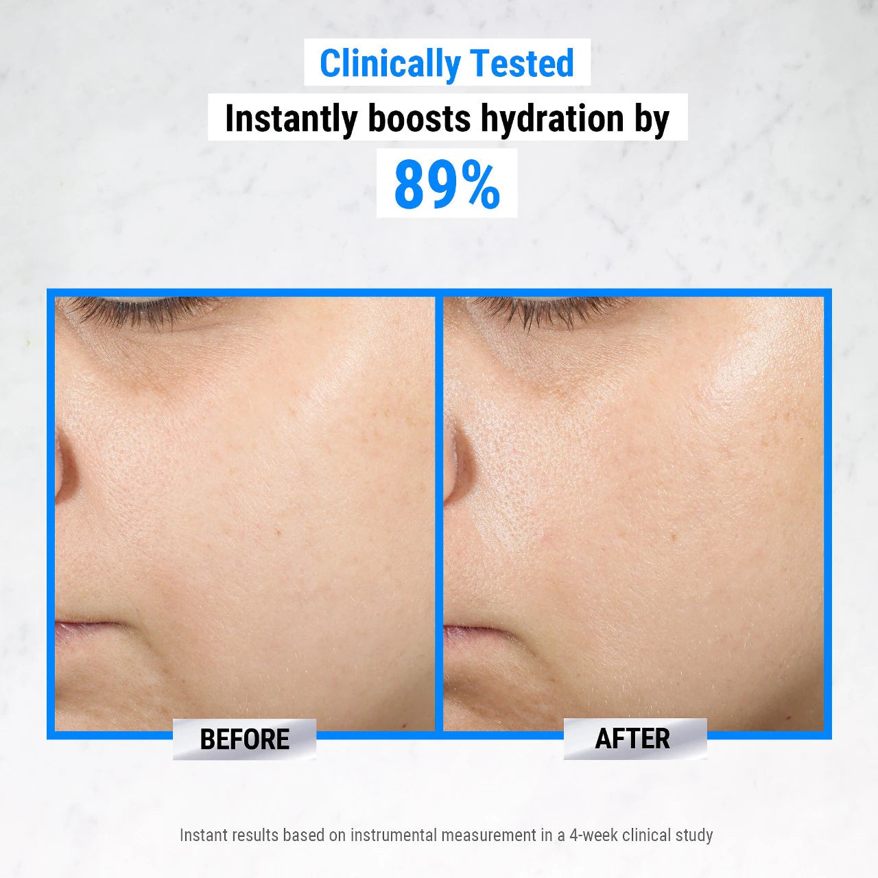 Ultra Pure Hyaluronic Acid 1.5% Serum