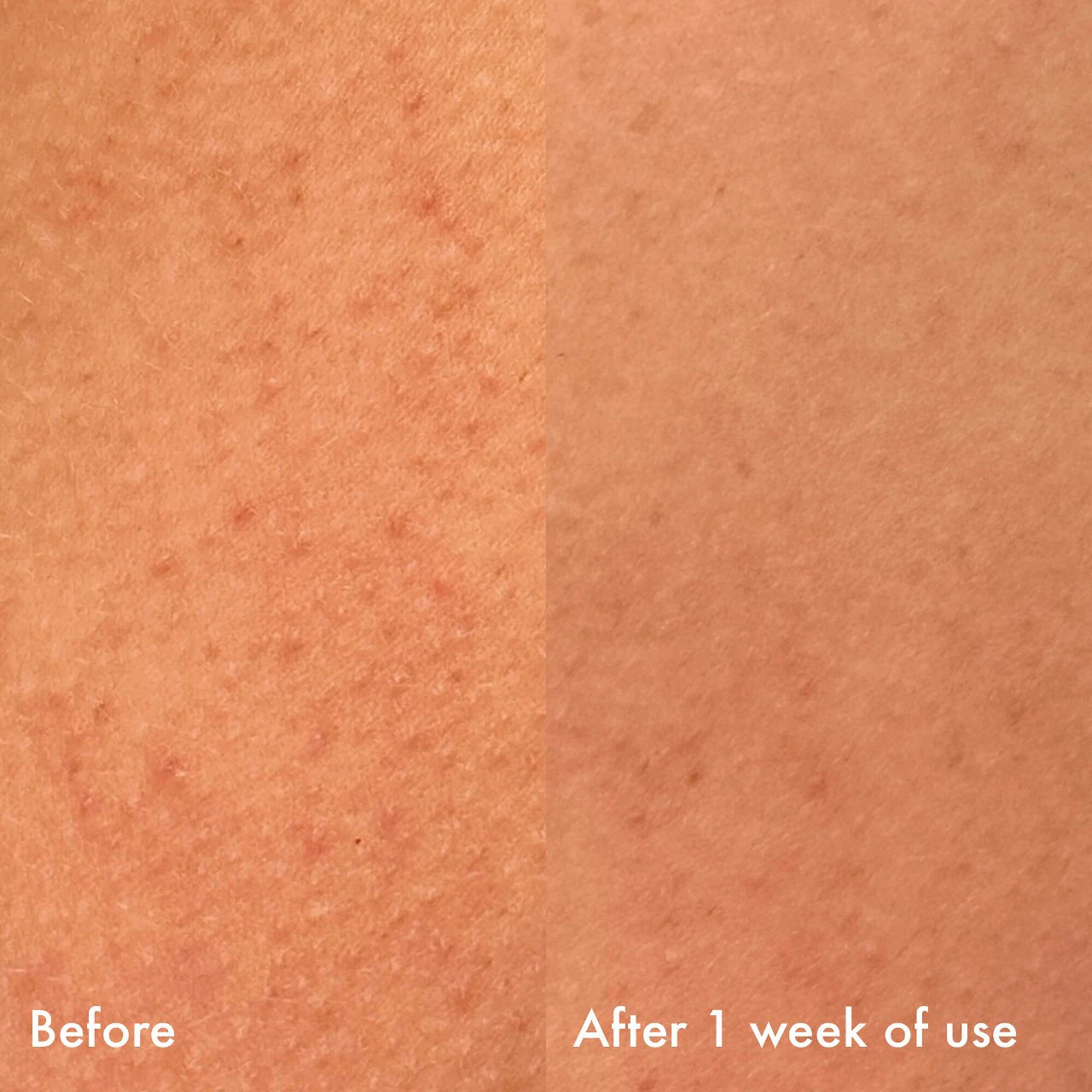 Confidently Clear Body Moisturizer with Lactic & Hyaluronic Acids