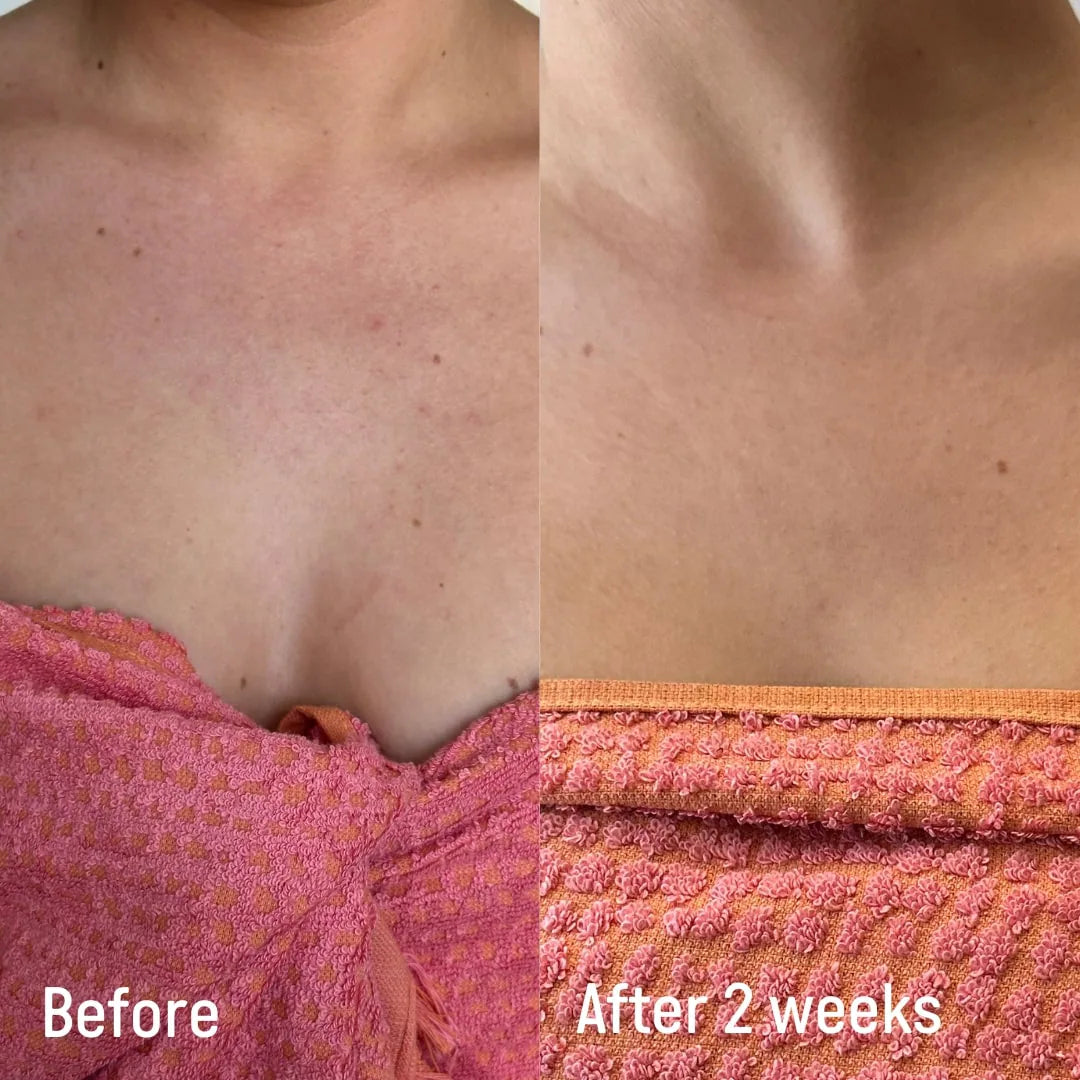Confidently Clear Body Moisturizer with Lactic & Hyaluronic Acids