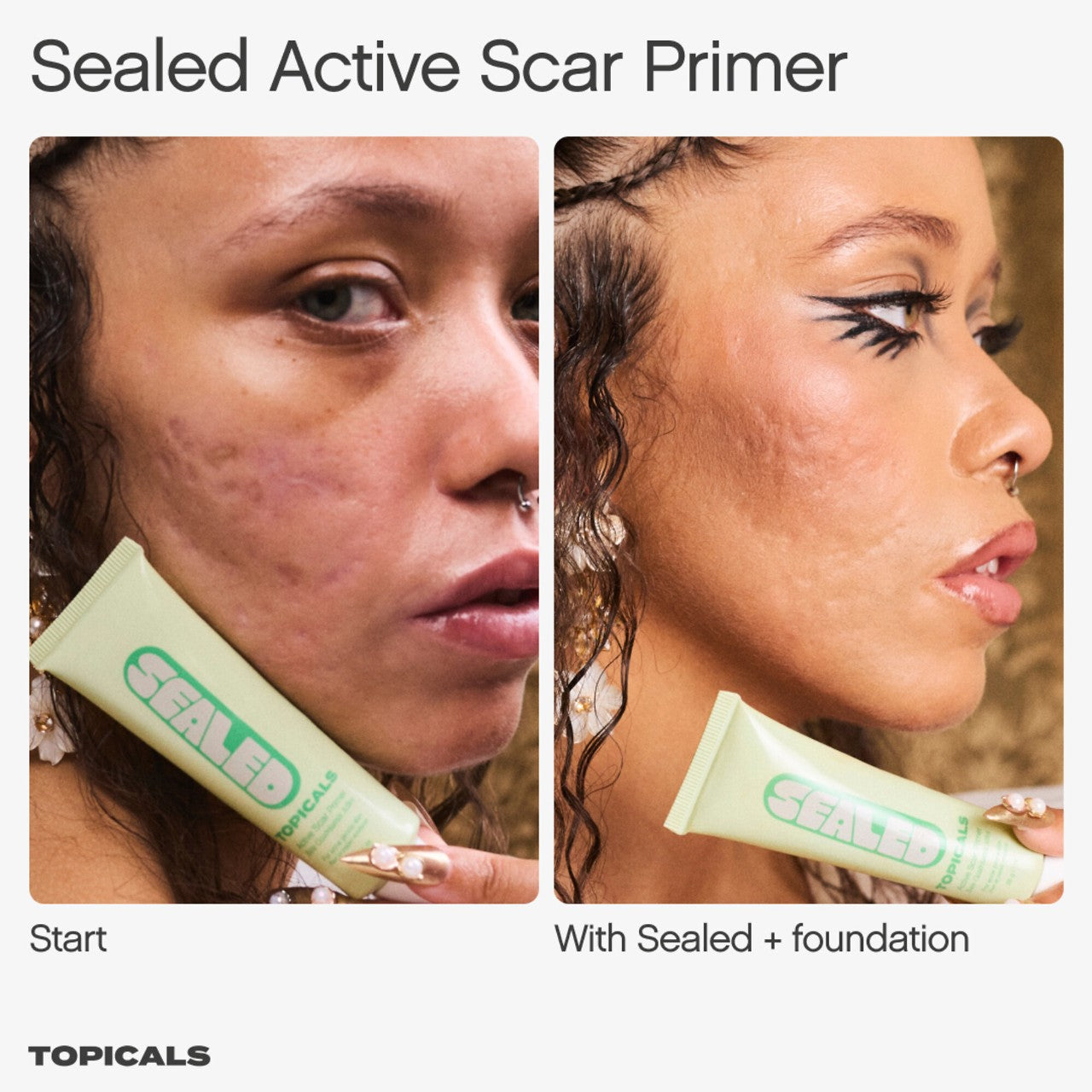 Sealed Active Scar Filling Primer for Acne Prone Skin