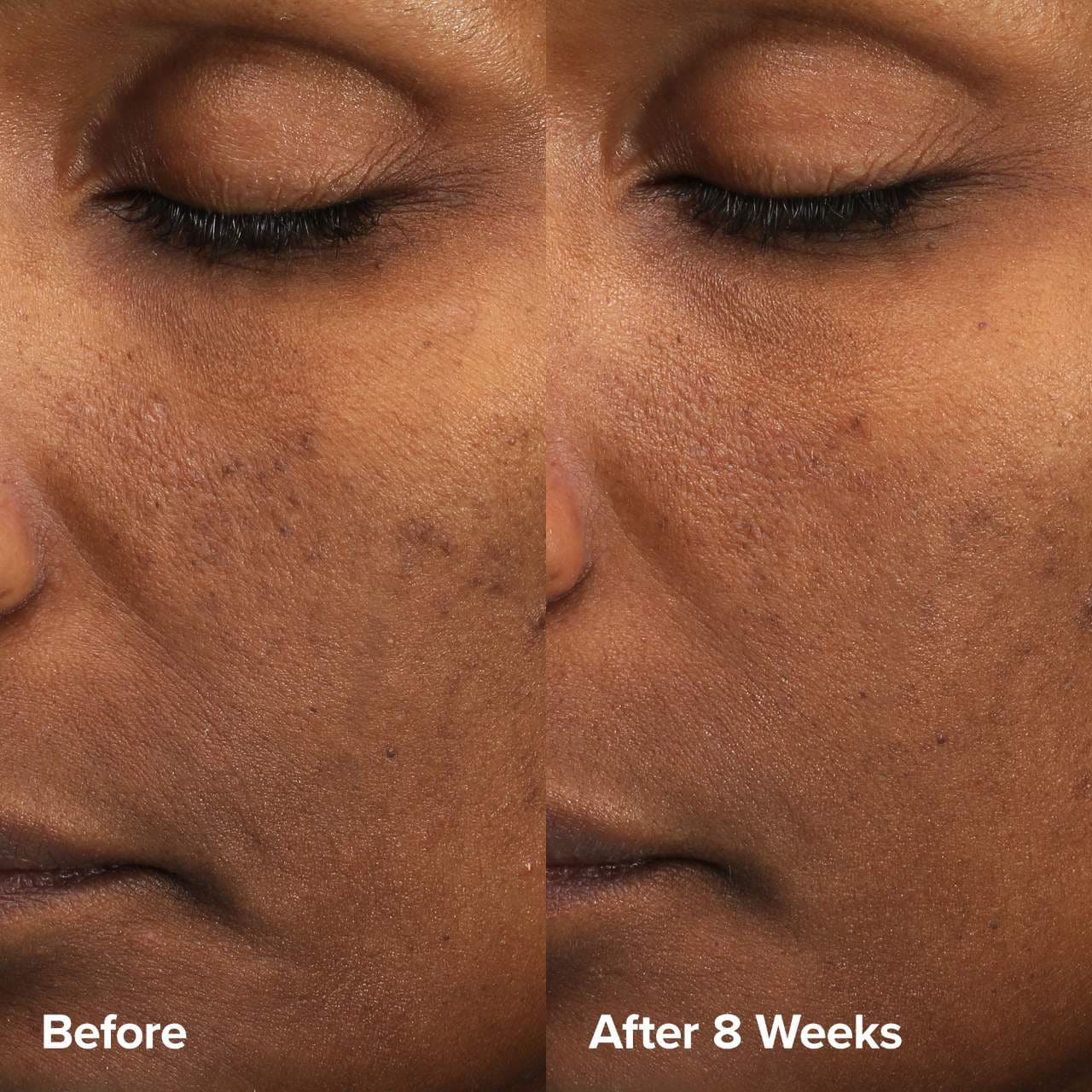 Skin Perfecting 6% Mandelic Acid + 2% Lactic Acid Liquid Exfoliant