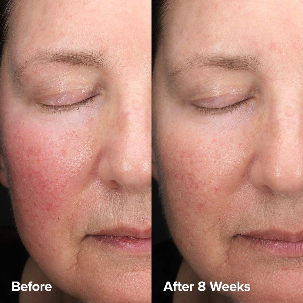 Skin Perfecting 6% Mandelic Acid + 2% Lactic Acid Liquid Exfoliant