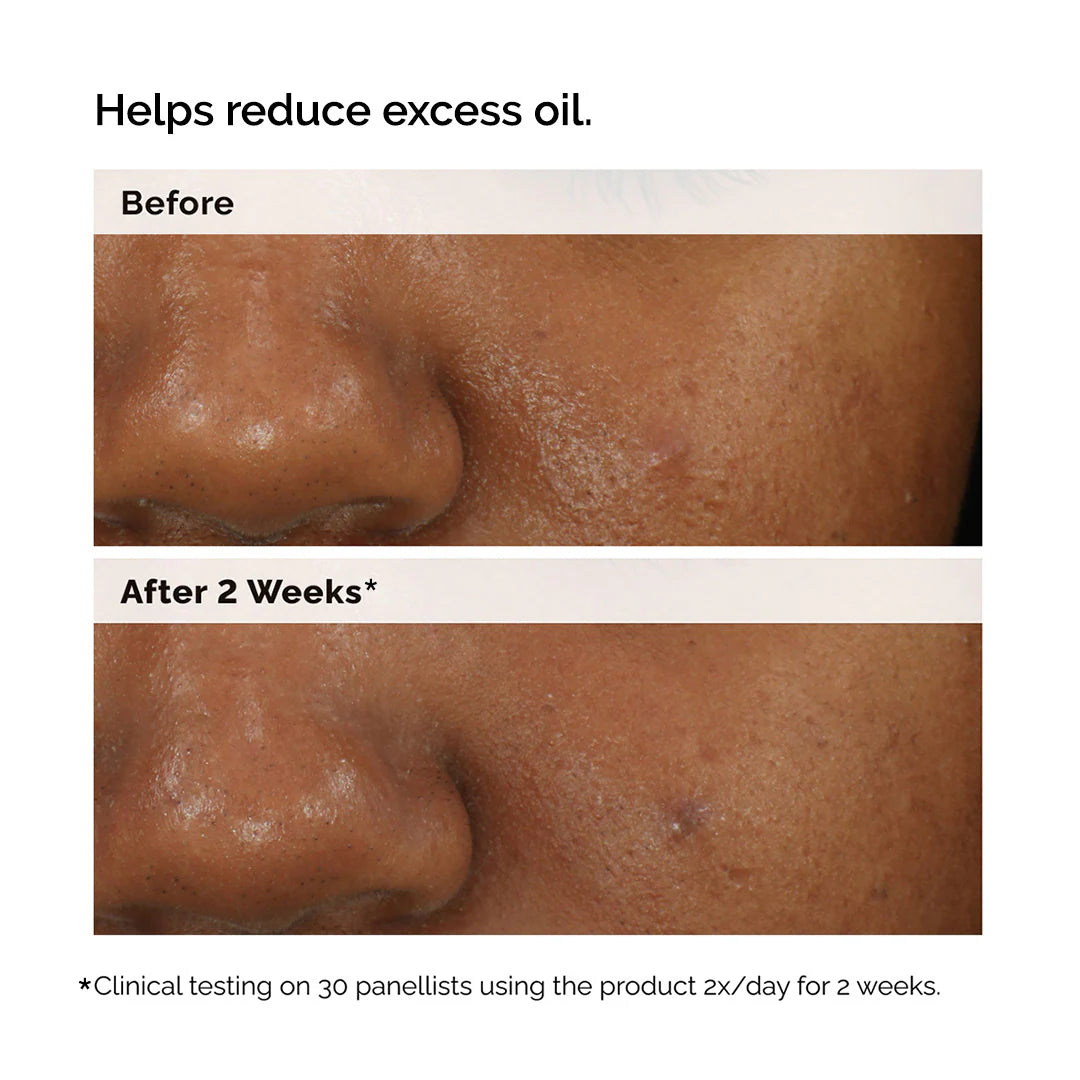 Balancing & Clarifying Serum for Oily Skin and Pore Refinement
