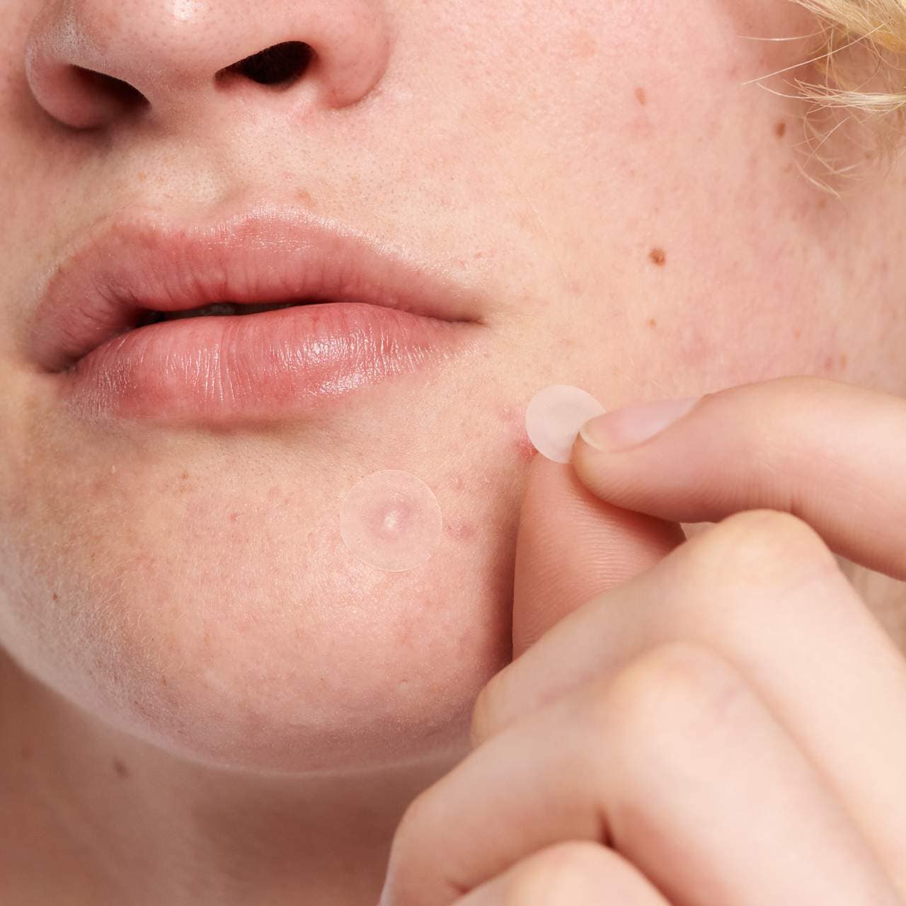Hydrocolloid Invisible Pimple Patches + Salicylic Acid