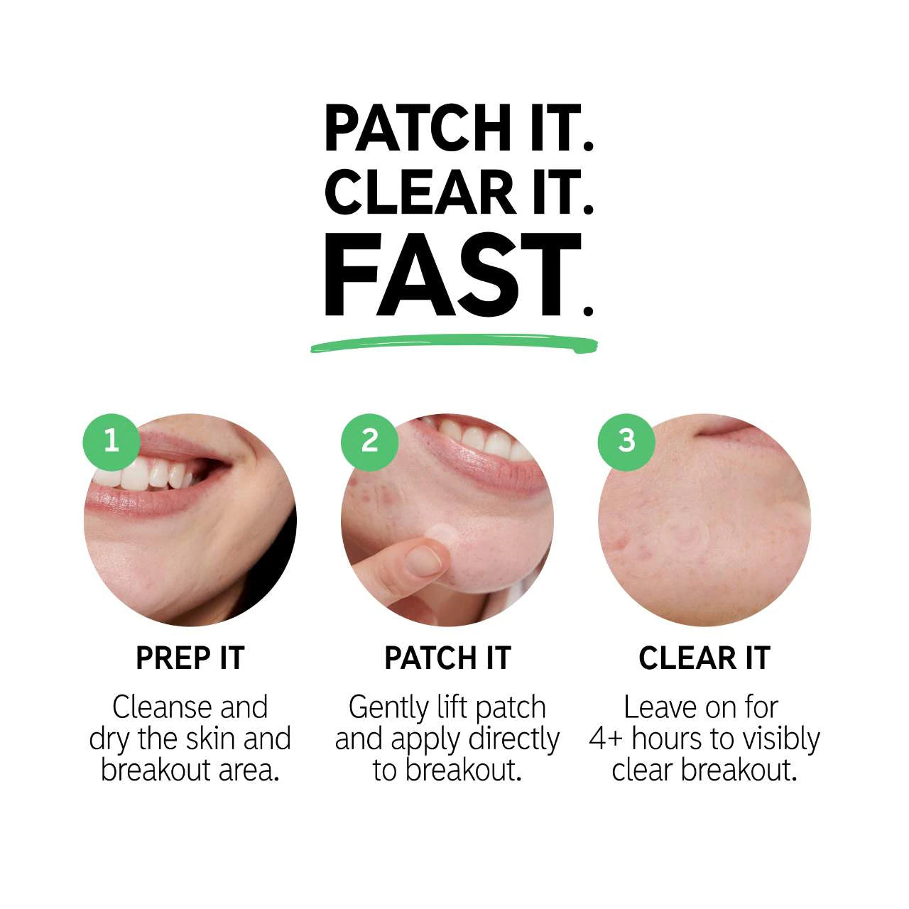 Hydrocolloid Invisible Pimple Patches + Salicylic Acid