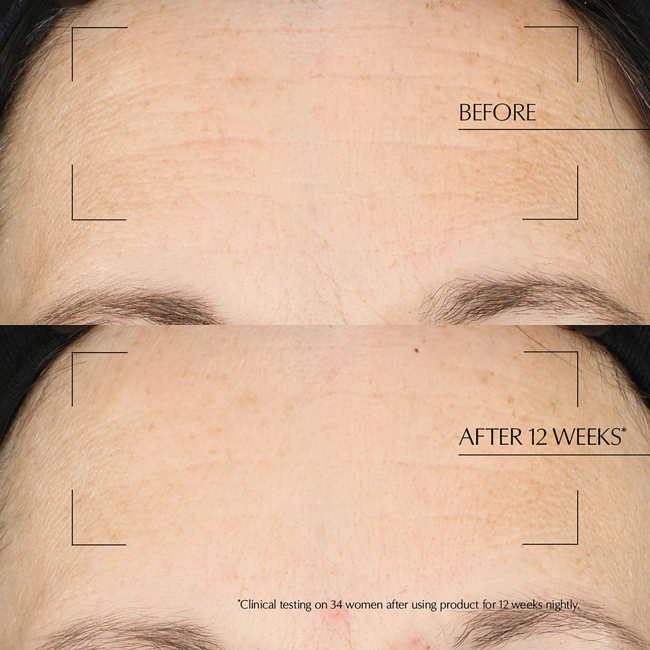 Advanced Night Repair Overninght Skin Treatment