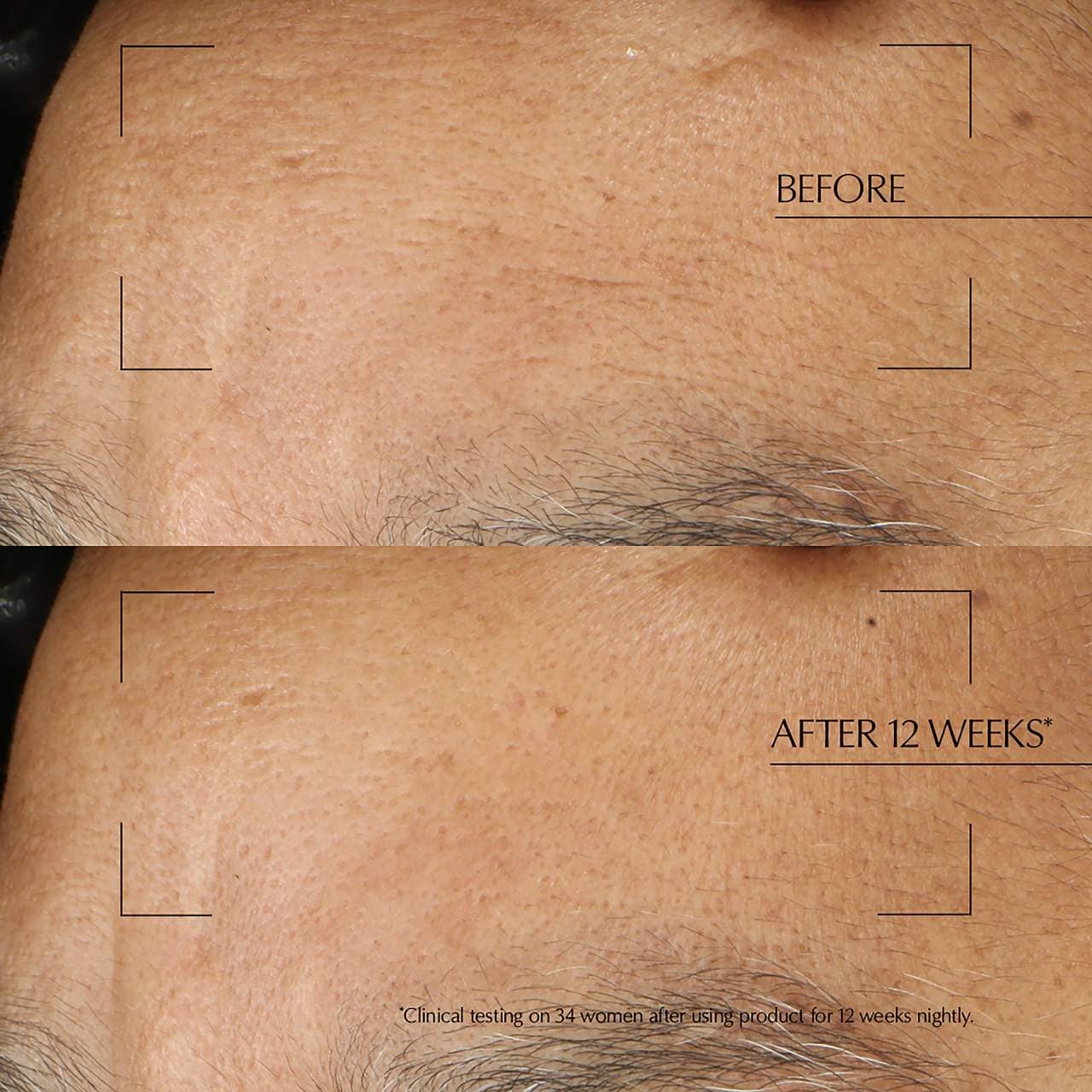 Advanced Night Repair Overninght Skin Treatment