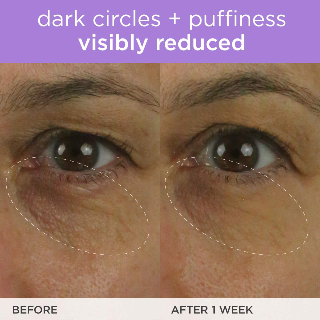 The Brightening Eye Cream with Vitamin C for Dark Circles