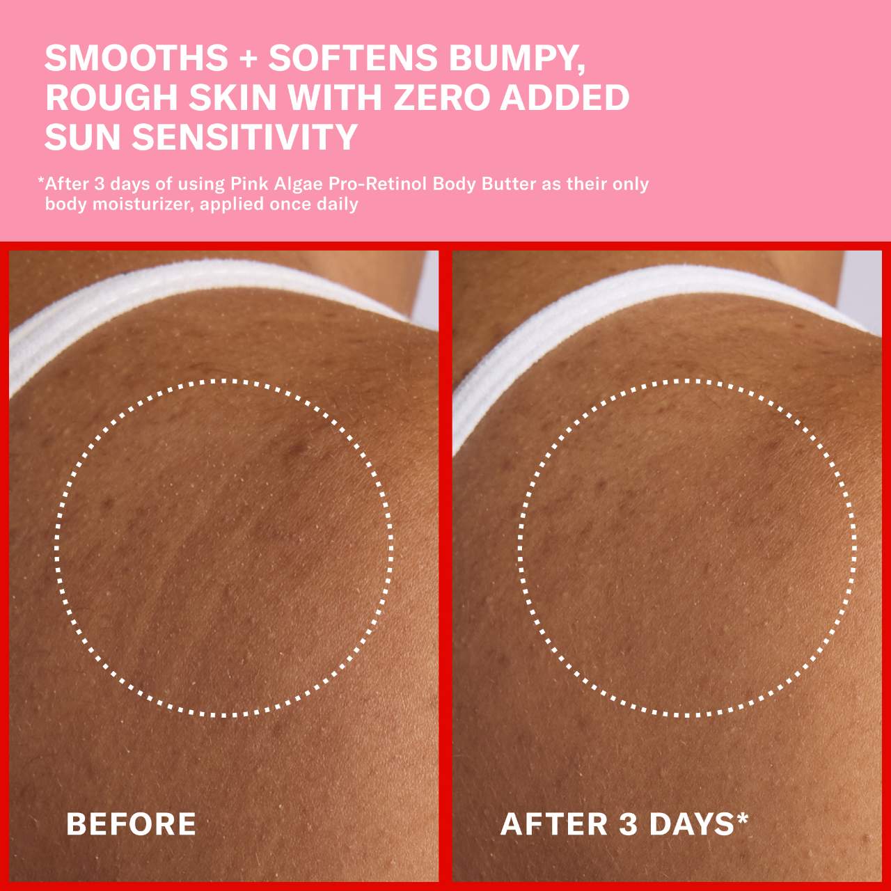 Pink Algae Pro-Retinol Body Butter for Anti-Aging and KP