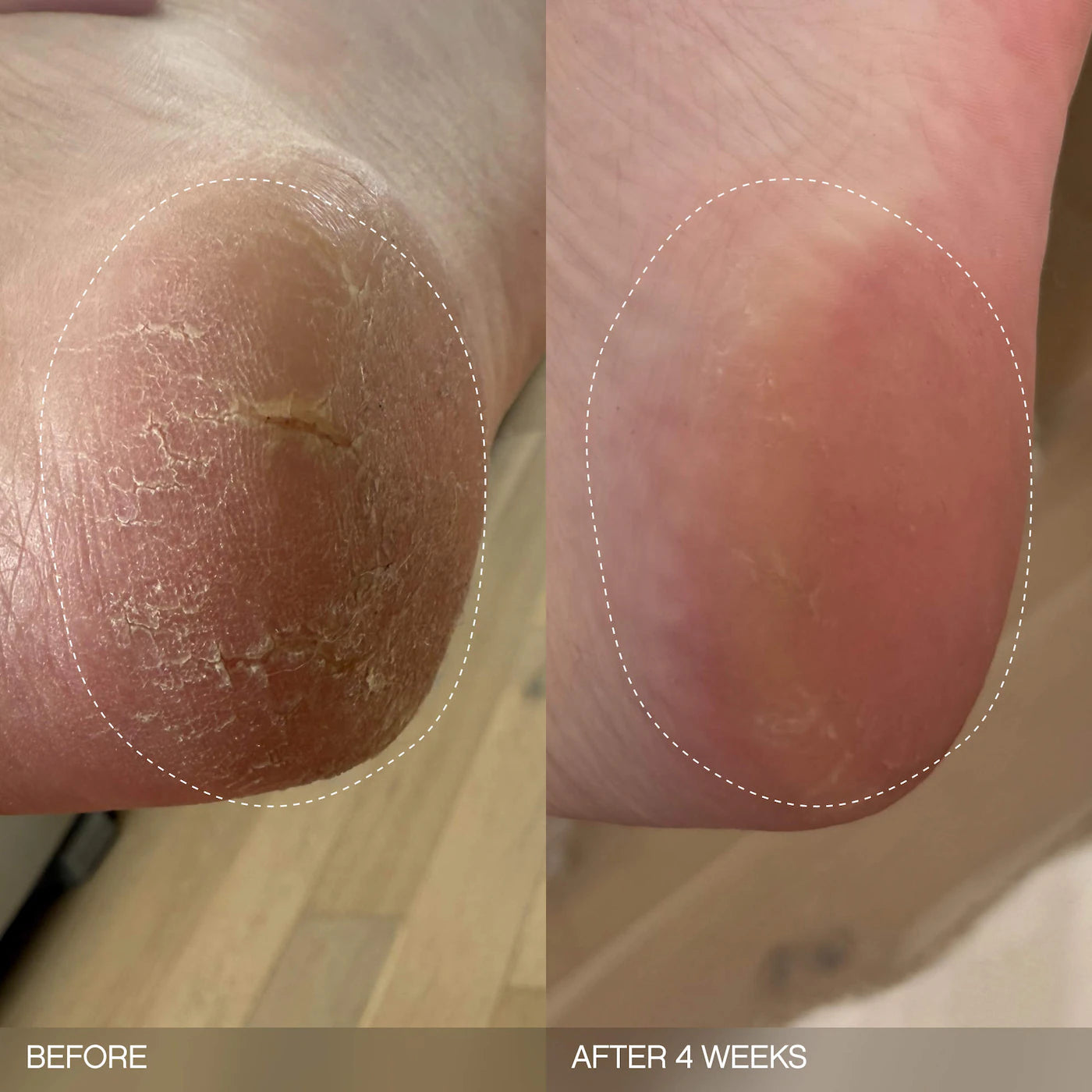 Slather Exfoliating & Smoothing Bar - For Soft Skin