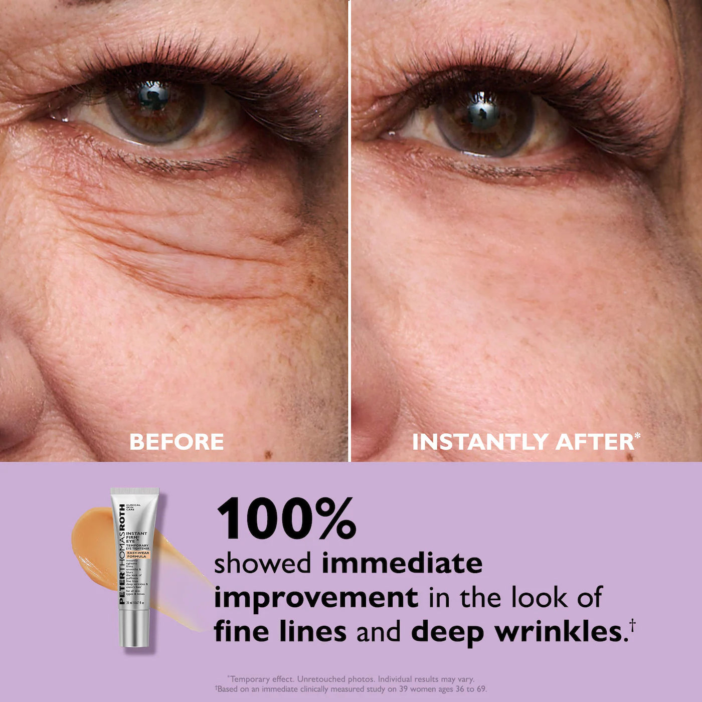 Instant FIRMx® Eye Temporary Eye Tightener Easy-Wear Formula for Firming Under-Eye Bags & Wrinkles