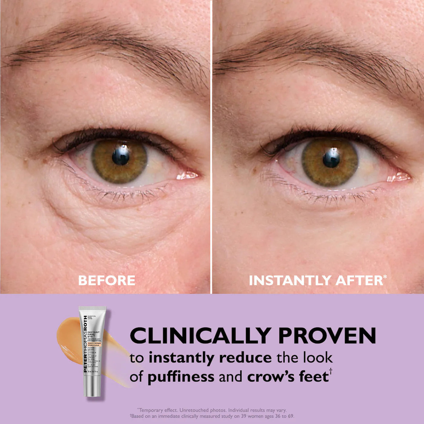 Instant FIRMx® Eye Temporary Eye Tightener Easy-Wear Formula for Firming Under-Eye Bags & Wrinkles