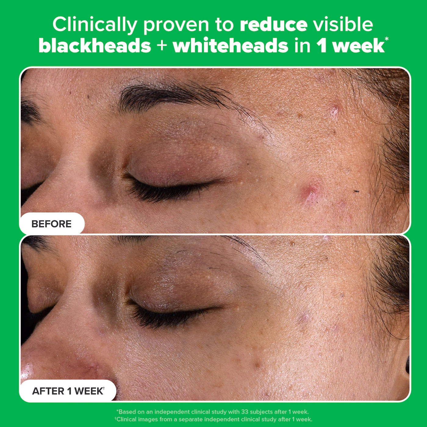 Complexion Clarity Duo with Salicylic Acid & Azelaic Acid
