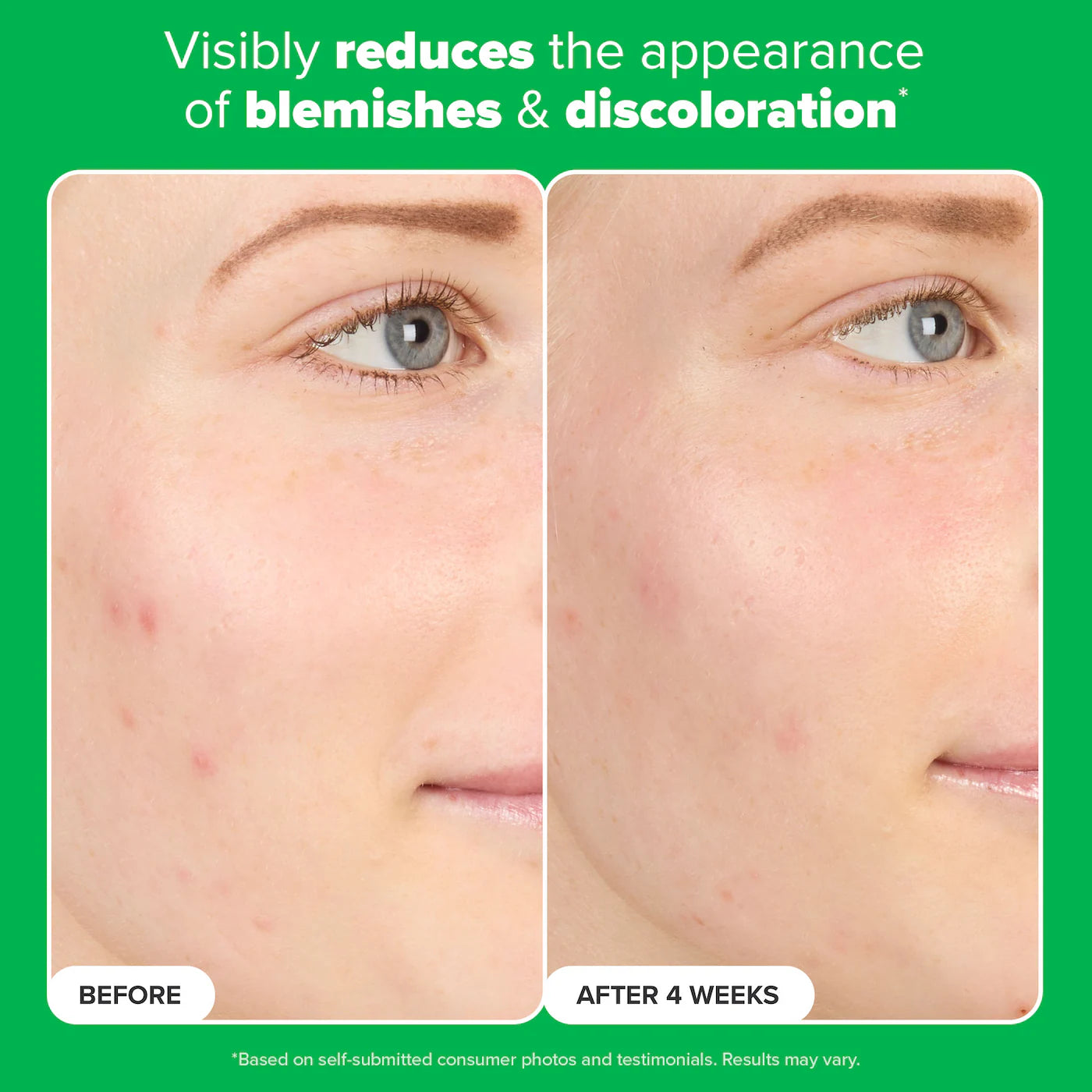 Complexion Clarity Duo with Salicylic Acid & Azelaic Acid