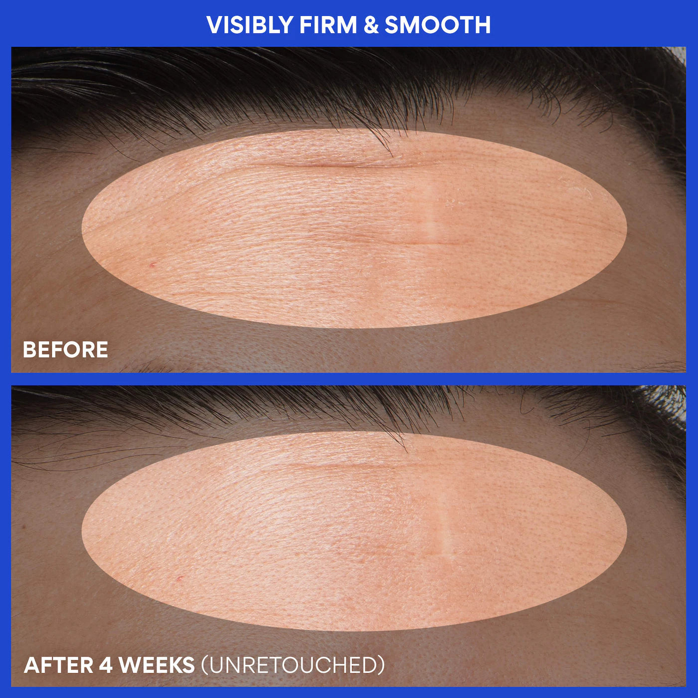 Retinol Green Tea PDRN™ Firming & Smoothing Serum