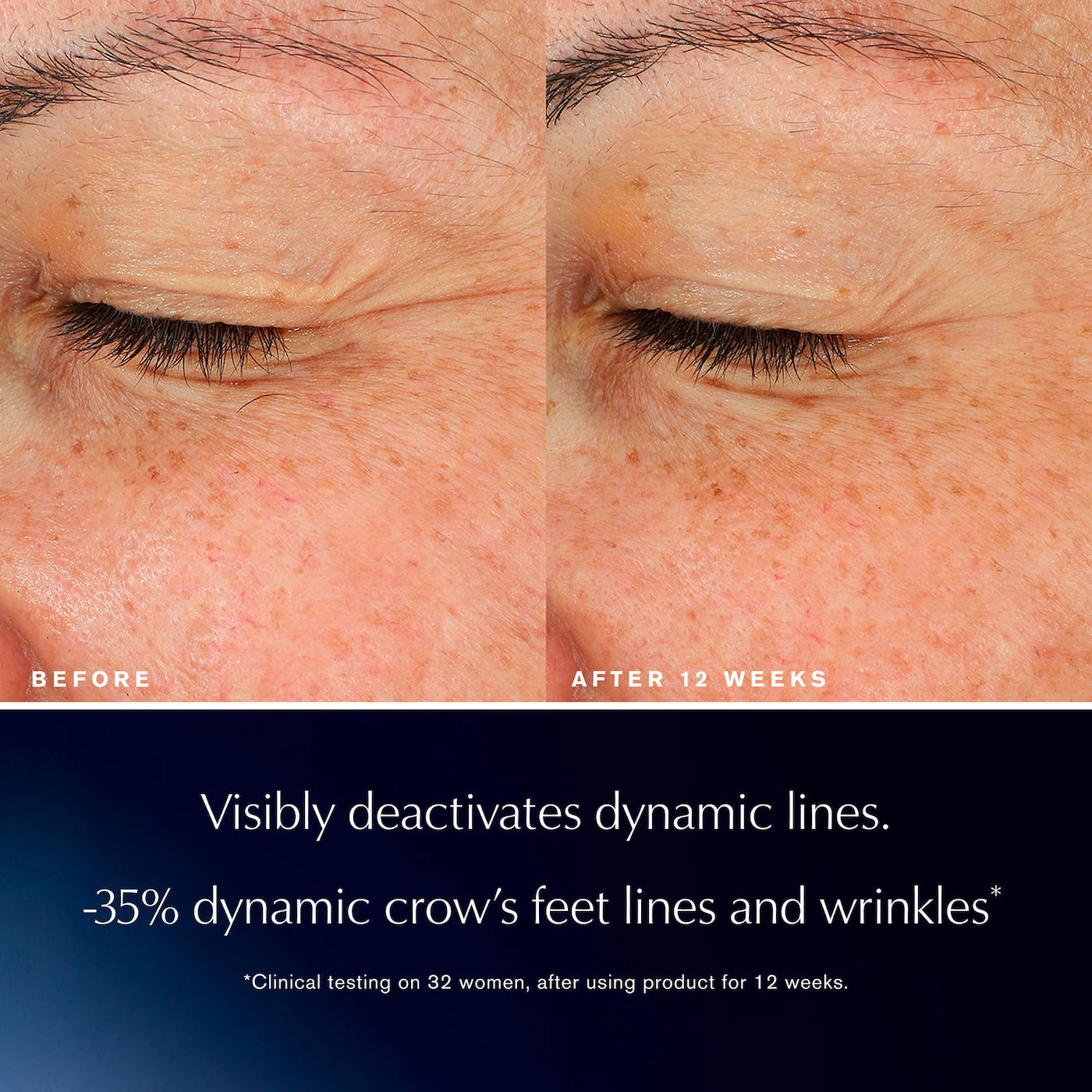 Advanced Night Repair Eye Lift + Sculpt Eye Cream