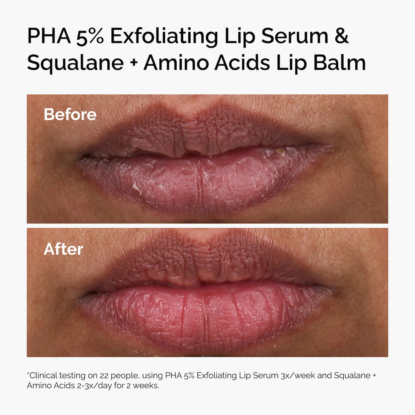 PHA 5% Exfoliating Lip Serum