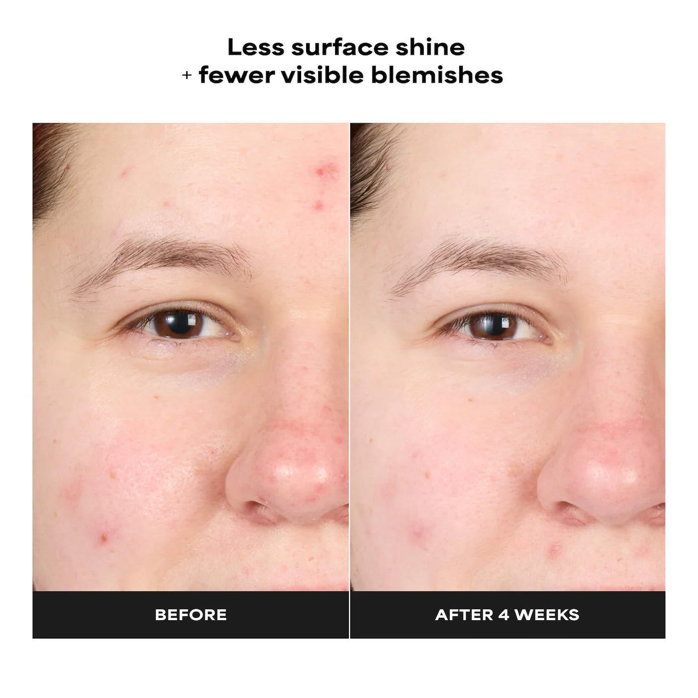 Skin Perfecting 4% BHA Advanced Exfoliating Serum Toner