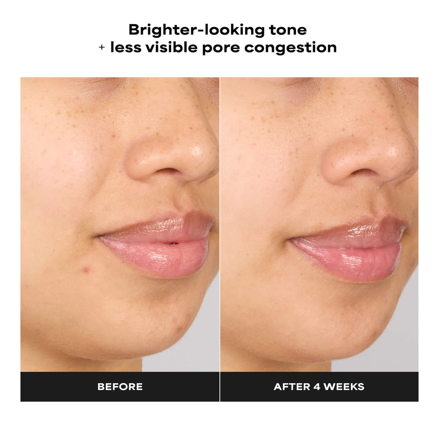 Skin Perfecting 4% BHA Advanced Exfoliating Serum Toner