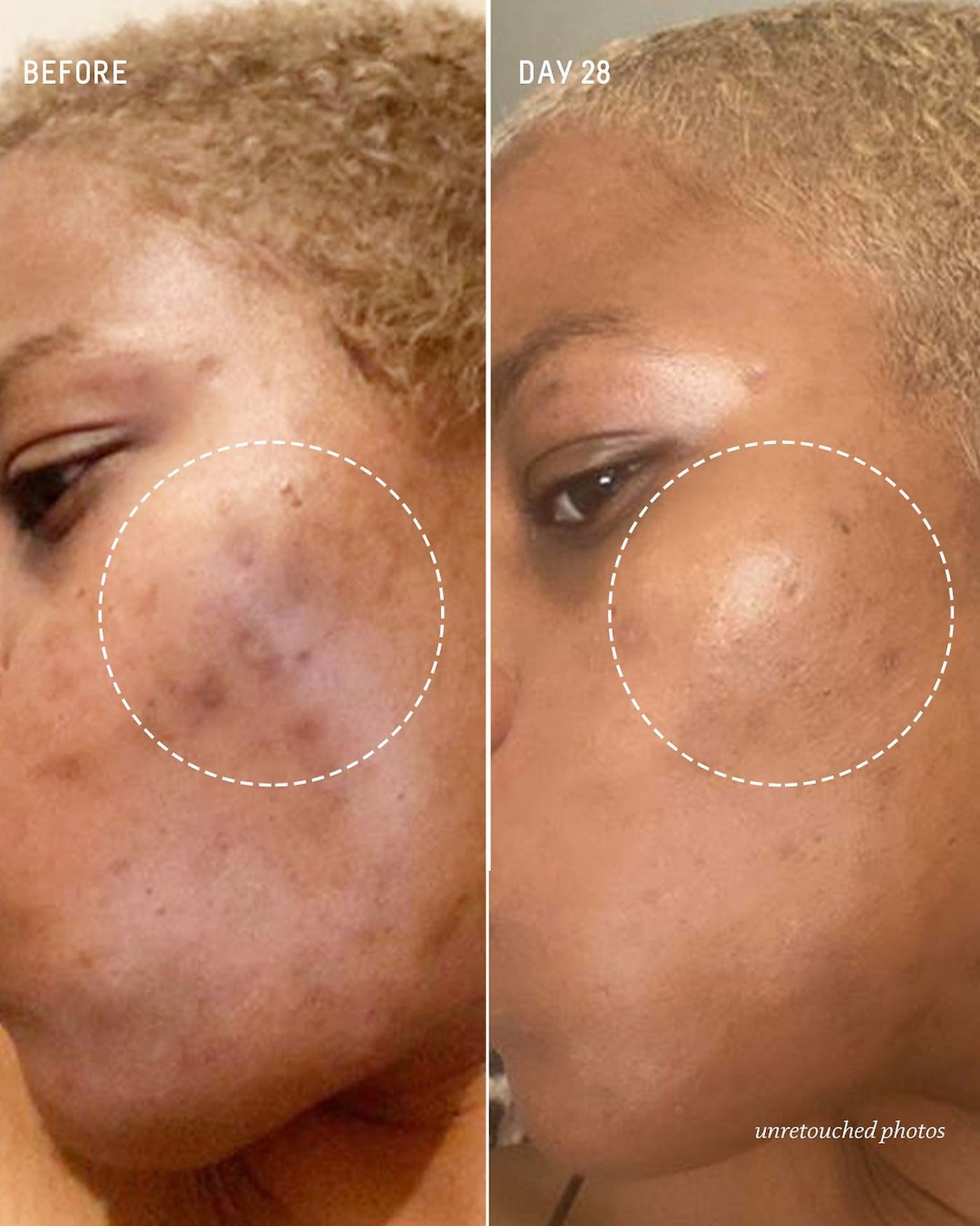 Squalane + 10% Lactic Acid Resurfacing Night Serum
