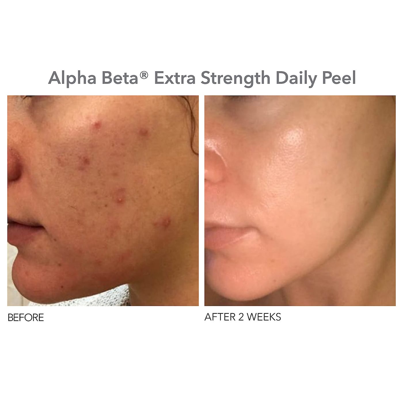 Peel + Protect